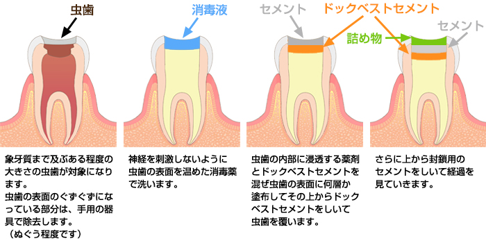 ドッグベストセメント療法