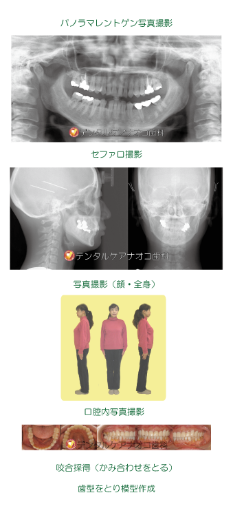 分析の流れ